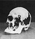 The skull of Andrew Borden