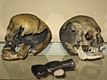 The skulls of Andrew and Abby Borden